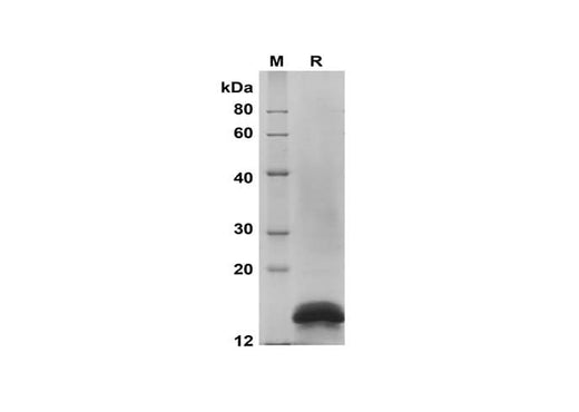 SDS-PAGE analysis of Human MKI67 proteins, 2 μg/lane of Recombinant Human MKI67 proteins was resolved with SDS-PAGE under reducing conditions, showing bands at 14 kDa.