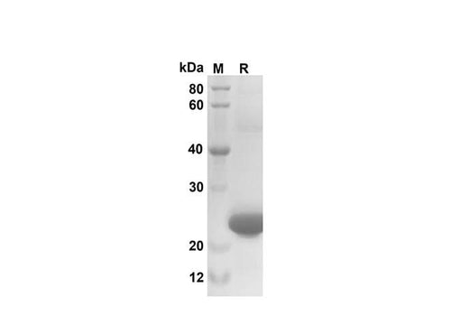 SDS-PAGE analysis of Mouse CXCL3/CINC-2α/β proteins, 2 μg/lane of Recombinant Mouse CXCL3/CINC-2α/β proteins was resolved with SDS-PAGE under reducing conditions, showing bands at 25 kDa.