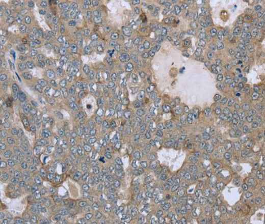 Anti-Human/Mouse FAR2 Antibody