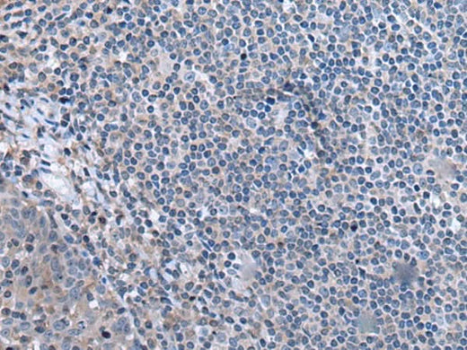 Immunohistochemistry of paraffin-embedded Human tonsil tissue using CCK Polyclonal Antibody at dilution of 1:55. (Original magnific at ion: ×200) at dilution of 1:55(×200)