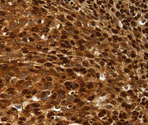 Anti-Human/Rat SCN1A/2A/3A/4A/5A/8A/9A/10A/11A/13A Antibody - ABMIUM