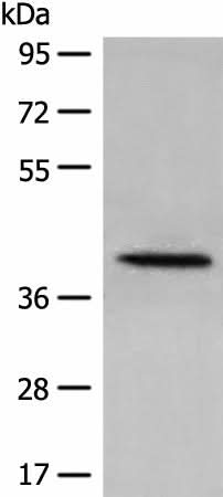 Western blot analysis of 231 cell lysate using DHRS7 Polyclonal Antibody at dilution of 1:400
