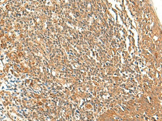 Anti-Human/Mouse/Rat TSHB Antibody - ABMIUM