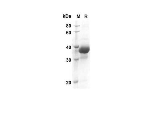 SDS-PAGE analysis of Rat CXCI3 proteins, 2 μg/lane of Recombinant Rat CXCI3 proteins was resolved with SDS-PAGE under reducing conditions, showing bands at 39.6 kDa.