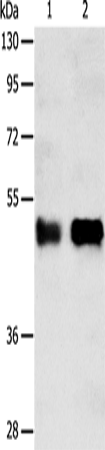 Anti-Human SERPINA5 Antibody - ABMIUM