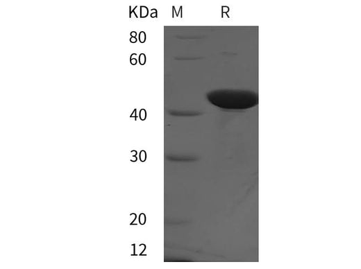 SDS-PAGE analysis of Rat PAI-1/ SerpinE1 proteins, 2 μg/lane of Recombinant Rat PAI-1/ SerpinE1 proteins was resolved with SDS-PAGE under reducing conditions, showing bands at 42 kDa.