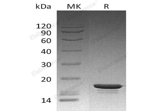 Recombinant Human STMN1 Protein (His Tag) - ABMIUM