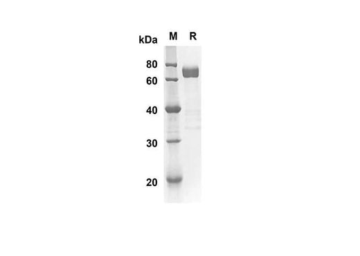 SDS-PAGE analysis of Mouse IL17RB proteins, 2 μg/lane of Recombinant Mouse IL17RB proteins was resolved with SDS-PAGE under reducing conditions, showing bands at 54.4 kDa.