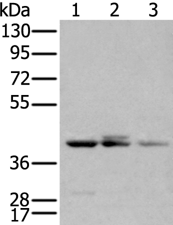 Anti-Human APOBEC3D Antibody - ABMIUM