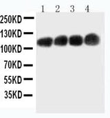 Anti-CEACAM5/Cd66e Monoclonal Antibody Boster Bio