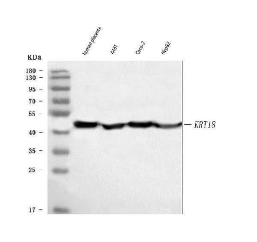 Anti-Cytokeratin Peptide 18 KRT18 Antibody (Monoclonal, CY-90) Boster Bio