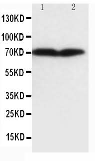 Anti-Collagen, Type III Col3a1 Antibody (Monoclonal, FH-7A) Boster Bio