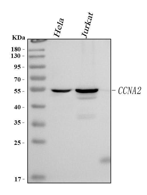 Anti-Cyclin A Ccna2 Antibody (Monoclonal, CY-A1) Boster Bio