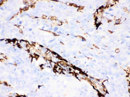Anti-Gelsolin Gsn Antibody (Monoclonal, GS-2C4) Boster Bio