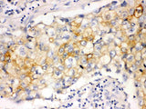 Anti-Involucrin Ivl Antibody (Monoclonal, SY5) Boster Bio