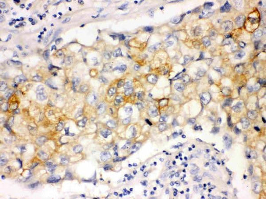 Anti-Involucrin Ivl Antibody (Monoclonal, SY5) Boster Bio