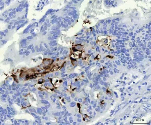 Anti-Mucin Gastric MUC5AC Antibody (Monoclonal, 45M1) Boster Bio
