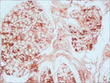 Anti-Myoglobin Mb Antibody (Monoclonal, MG-1) Boster Bio
