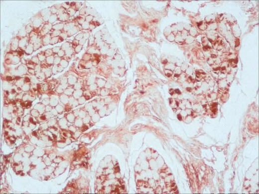 Anti-Myoglobin Mb Antibody (Monoclonal, MG-1) Boster Bio
