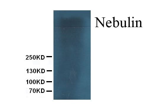 Anti-Nebulin Antibody (Monoclonal, NB2) Boster Bio