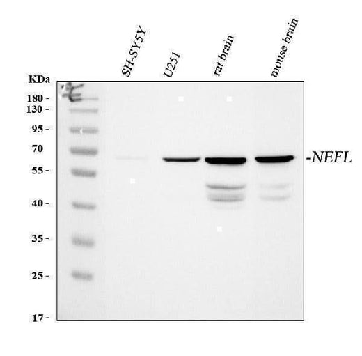 Anti-NF68 Nefl Antibody (Monoclonal, NR4) Boster Bio