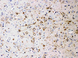 Anti-NEFH Antibody (Monoclonal, N52) Boster Bio