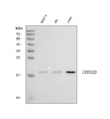 Anti-p19INK4d Cdkn2d Antibody (Monoclonal, DCS-100) Boster Bio