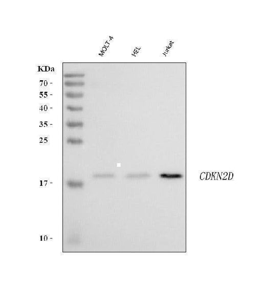Anti-p19INK4d Cdkn2d Antibody (Monoclonal, DCS-100) Boster Bio