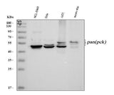 Anti-Pan cytokeratin Antibody (Monoclonal, PCK-26) Boster Bio