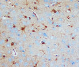 Anti-S-100(Beta-subunit) S100b Antibody (Monoclonal, SH-B1) Boster Bio