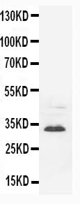 Anti-Synaptophysin Syp Antibody (Monoclonal, SVP-38) Boster Bio