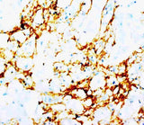 Anti-Tenascin TNN Antibody (Monoclonal, BC-24) Boster Bio