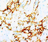 Anti-Tenascin TNN Antibody (Monoclonal, BC-24) Boster Bio