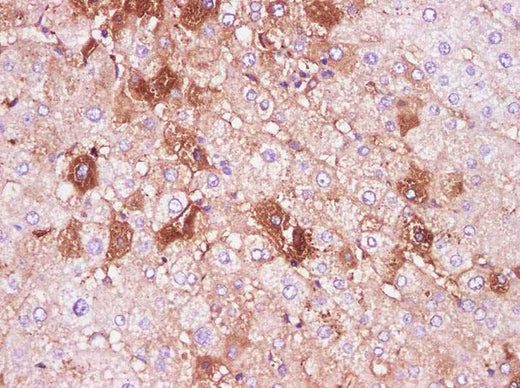 Anti-Human IL-6 Antibody - ABMIUM
