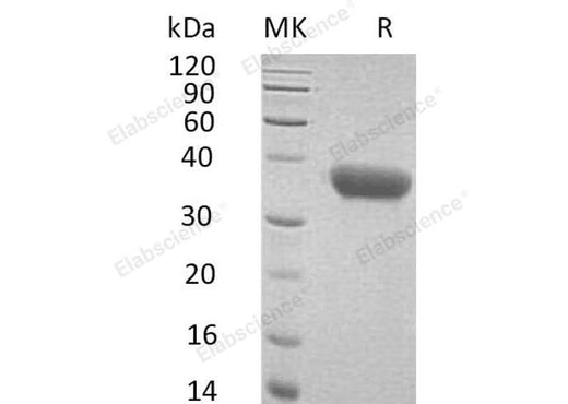 Recombinant Mouse CXCL16 Protein (His Tag) - ABMIUM