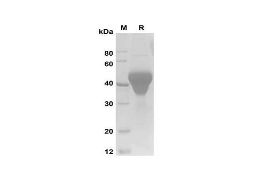 SDS-PAGE analysis of Mouse Fcer2 proteins, 2 μg/lane of Recombinant Mouse Fcer2 proteins was resolved with SDS-PAGE under reducing conditions, showing bands at 35-45 kDa.