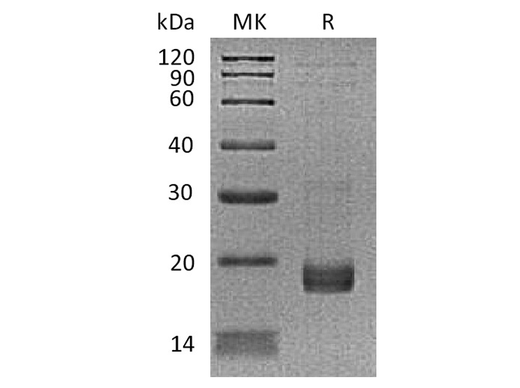 Recombinant Human Troponin C/TNNC1 Protein (His Tag) - ABMIUM