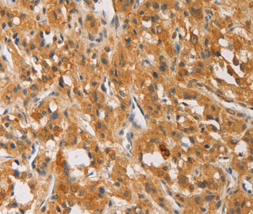 Anti-Human/Mouse ATG4D Antibody - ABMIUM