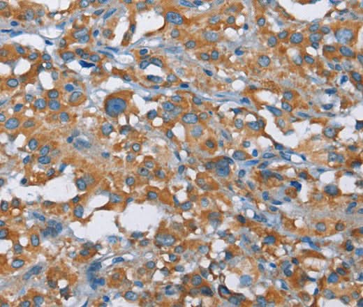 Anti-Human KLF7 Antibody - ABMIUM