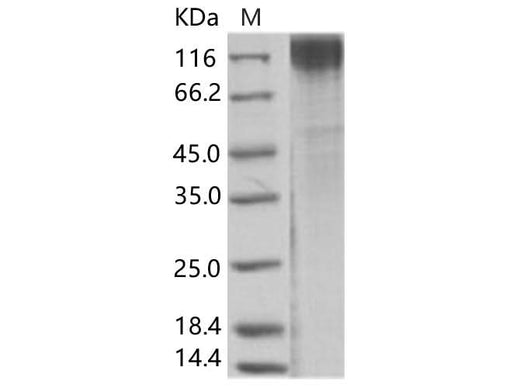 > 85 % as determined by reducing SDS-PAGE.
