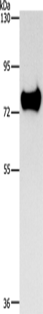 Anti-Human/Mouse/Rat SYN1 Antibody - ABMIUM