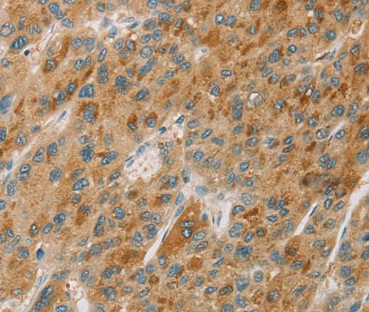 Anti-Human CYP11B1 Antibody - ABMIUM