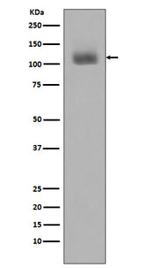 Anti-Phospho-JAK2 (Y1007 + Y1008) Monoclonal Antibody Boster Bio