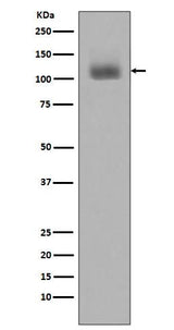 Anti-Phospho-JAK2 (Y1007 + Y1008) Monoclonal Antibody Boster Bio