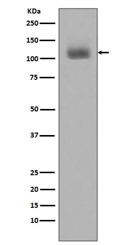 Anti-Phospho-JAK2 (Y1007 + Y1008) Monoclonal Antibody Boster Bio