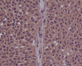 Anti-Phospho-CDK2 (Y15) Rabbit Monoclonal Antibody Boster Bio