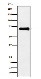 Anti-Phospho-PAK4 + PAK5 + PAK6 (S474 + S560 + S602) Monoclonal Antibody Boster Bio