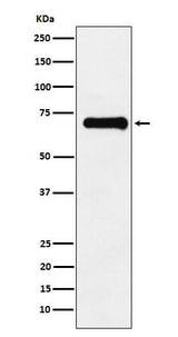Anti-Phospho-PAK4 + PAK5 + PAK6 (S474 + S560 + S602) Monoclonal Antibody Boster Bio