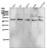 Anti-Phospho-JNK1/2/3 (T183+T183+T221) MAPK8 Monoclonal Antibody Boster Bio