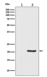 Anti-Phospho-Bad (S112) Monoclonal Antibody Boster Bio